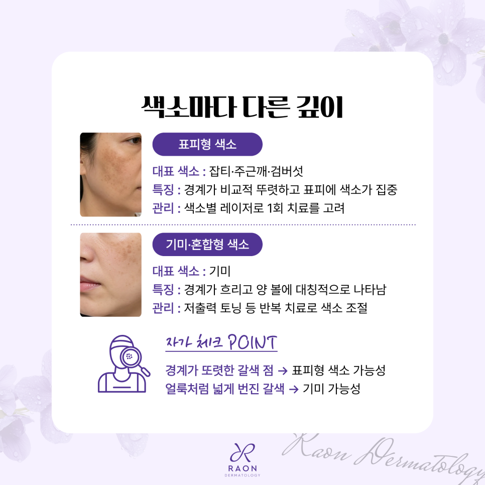 원데이 색소치료 효과 있을까? 왕십리 피부과 전문의 팩트 체크 관련 이미지 2