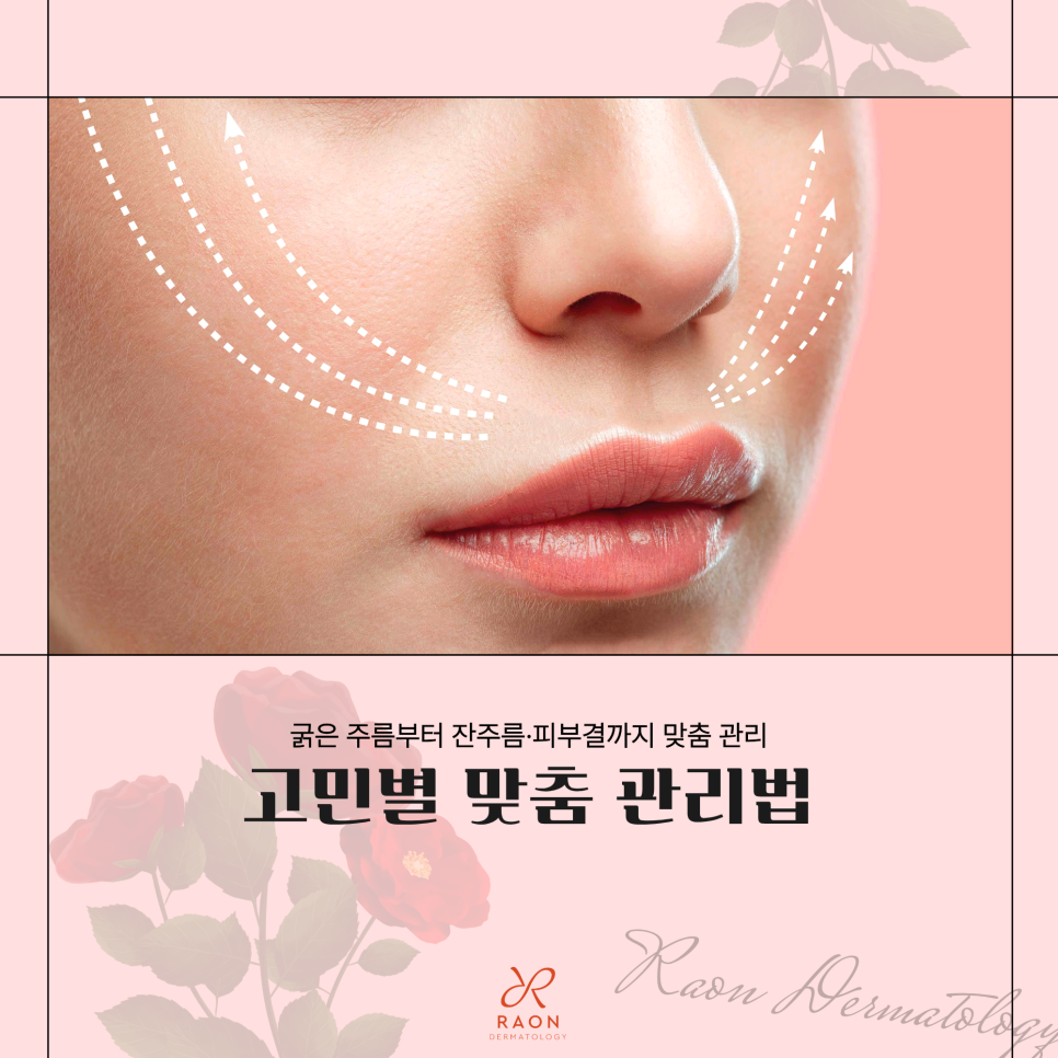 Five Customized Treatment Approaches by Concern from a Dermatologist in Seongdong-gu [Deep Wrinkles, Fine Wrinkles, Skin Texture, and More] image 1