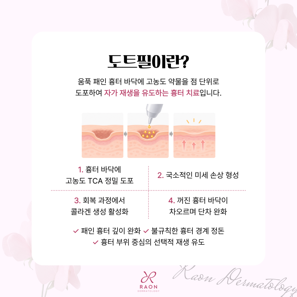 왕십리 피부과 여드름 흉터 도트필과 서브시전 피부과 전문의 치료가 필요한 이유? 관련 이미지 2