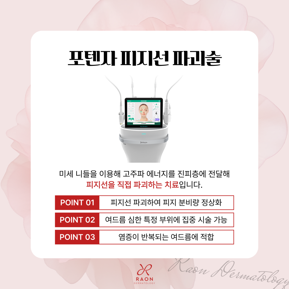 Recurring Acne That Keeps Coming Back: Acne Treatment Methods by Type at Haengdang Station Dermatology Clinic (Including Sebaceous Gland Destruction, Black Peel) image 4