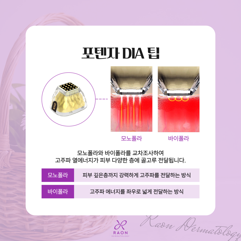 왕십리 전문의 피부과 포텐자 다이아 리프팅, 통증과 실제 효과는? 관련 이미지 4