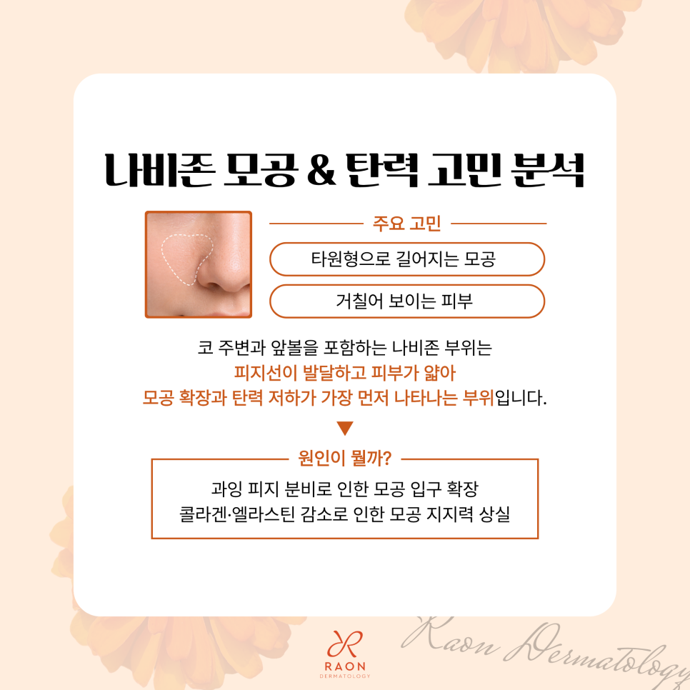 Seongdong-gu Dermatology: Two Ways to Manage Enlarged Pores and Loss of Firmness in the Butterfly Zone [Potenza & ReSFX] image 2
