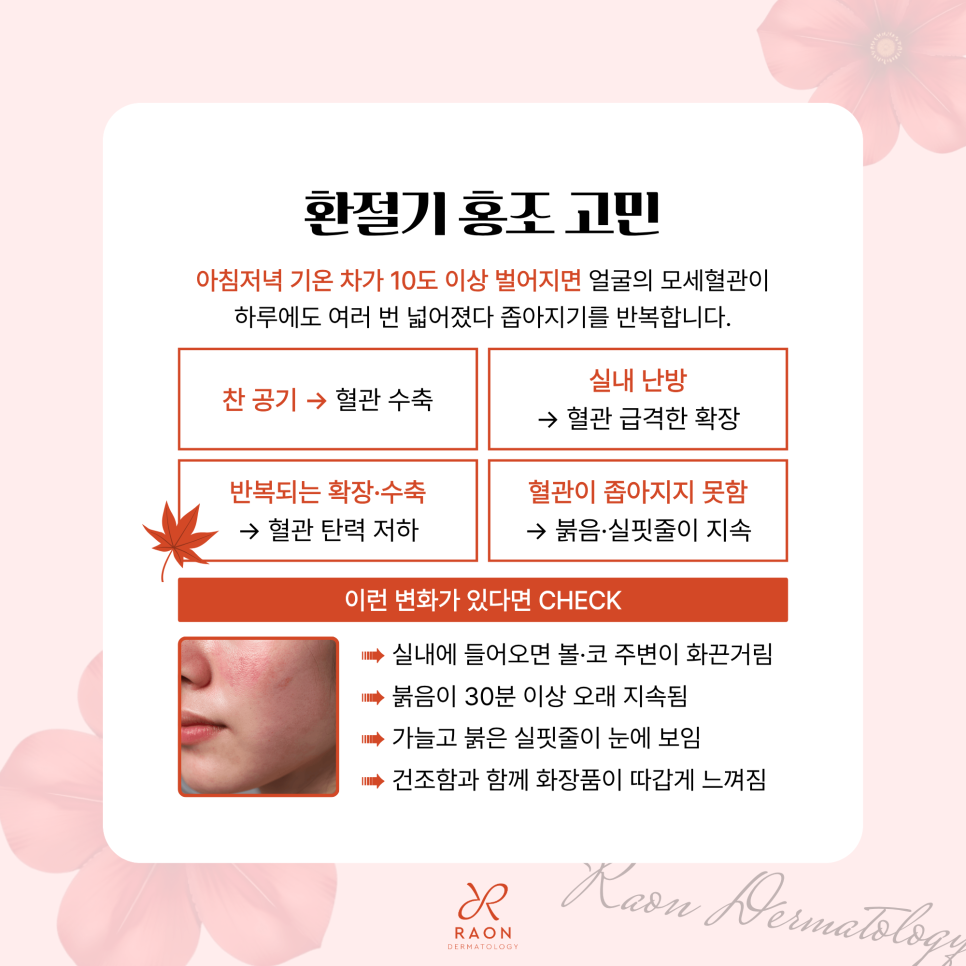 성동구 피부과 전문의 환절기 홍조는 DDR 혈관 레이저로, 적정 치료 주기는? 관련 이미지 2