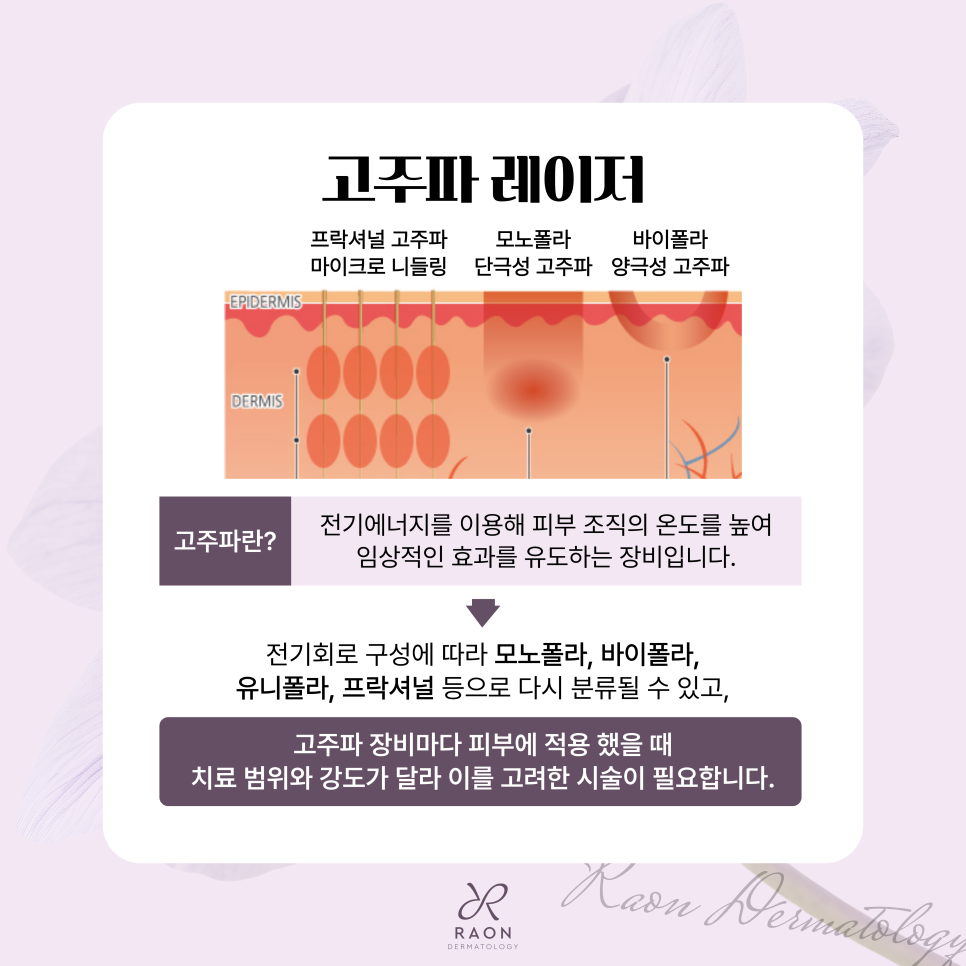 왕십리역 피부과 전문의 여드름 등 바늘 고주파 시술 이해하기 [백종헌 원장 칼럼] 관련 이미지 3