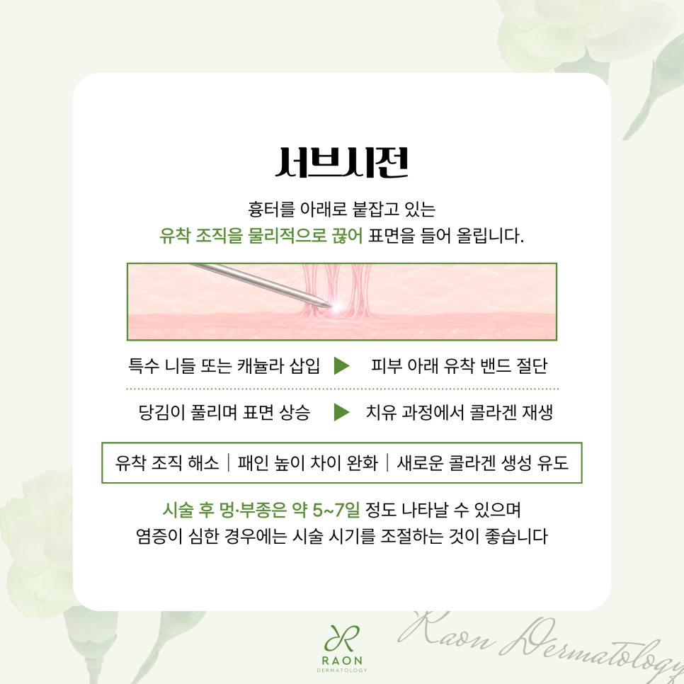 왕십리피부과 서브시전부터 미라젯, 쥬베룩까지 여러 여드름 흉터 치료법을 병행하면? 관련 이미지 3