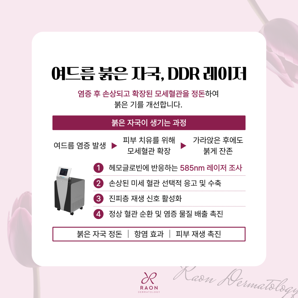 Seongdong-gu Dermatology Clinic: Step-by-Step Acne Care, from Sebum Production to Enlarged Pores image 3
