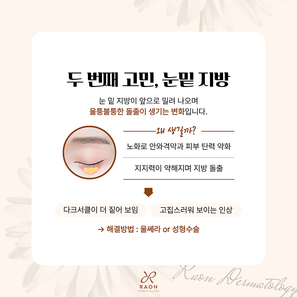 성동구 피부과 눈밑 꺼짐과 지방 돌출 수술 외엔 답이 없을까? [레티젠, 아이울쎄라] 관련 이미지 4