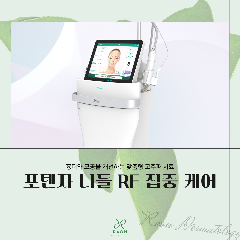 금호동 피부과 포텐자 고주파로 흉터 및 모공 문제 개선하기 관련 이미지 1