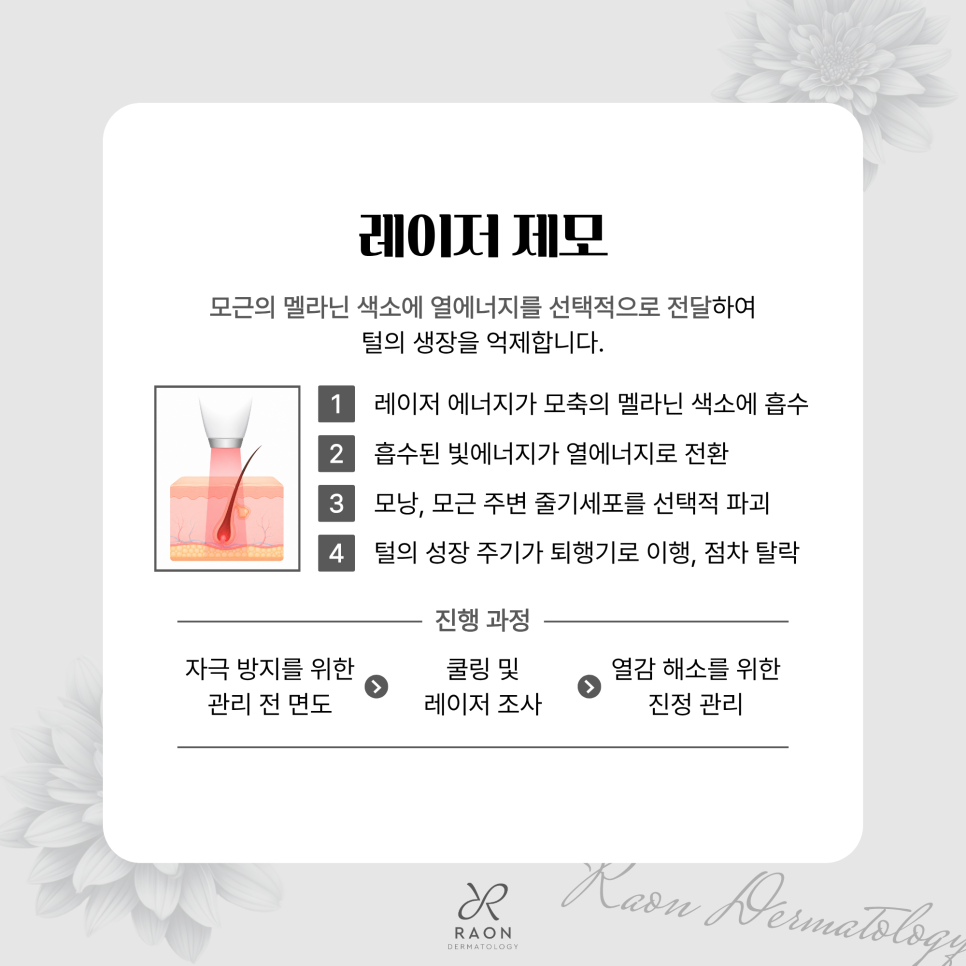 왕십리피부과 여름철 다한증 보톡스와 레이저 제모로 위생적인 피부 상태 유지하기 관련 이미지 4