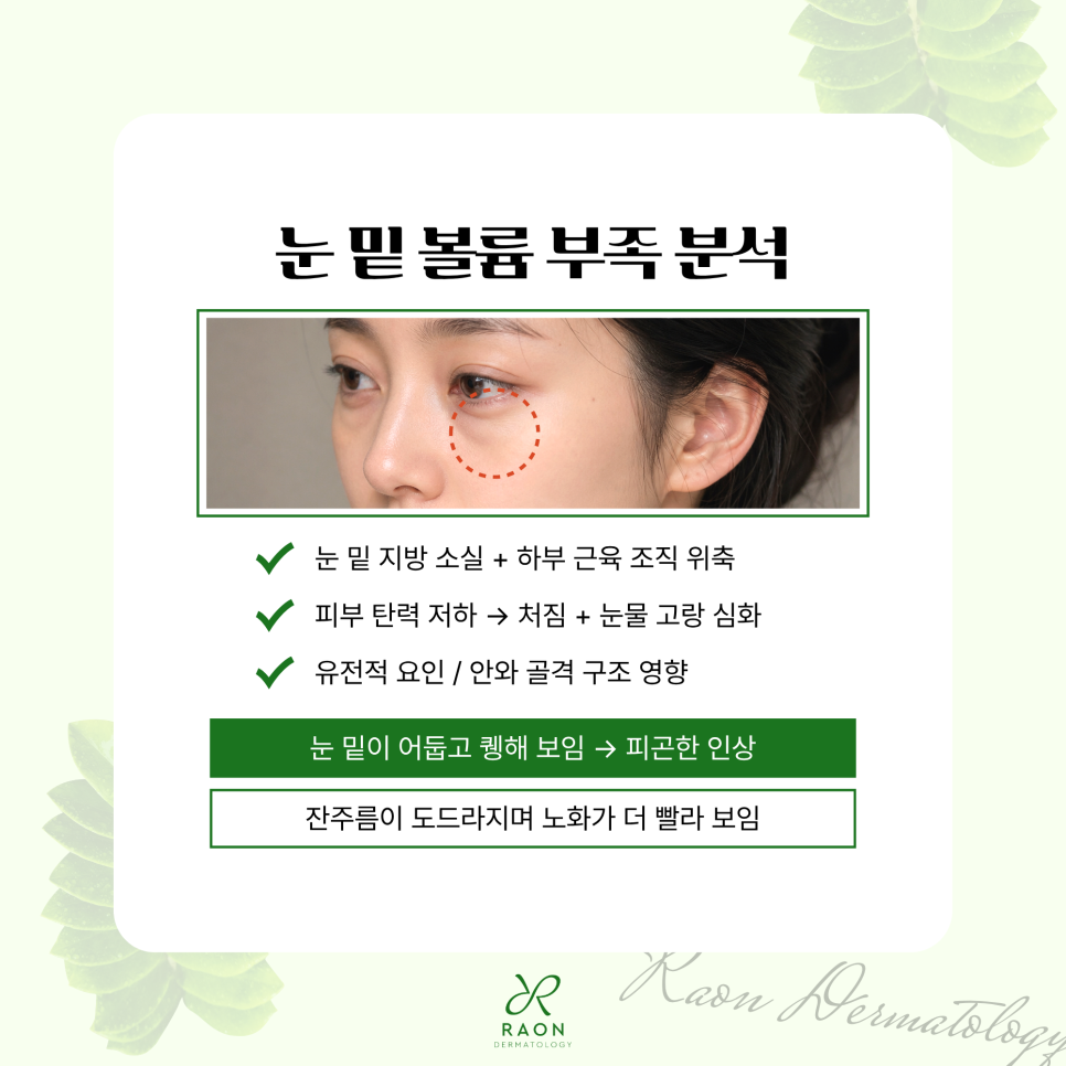 왕십리 피부과 눈 밑 꺼짐 및 볼륨 부족 리투오와 레티젠이 적합한 이유? 관련 이미지 2