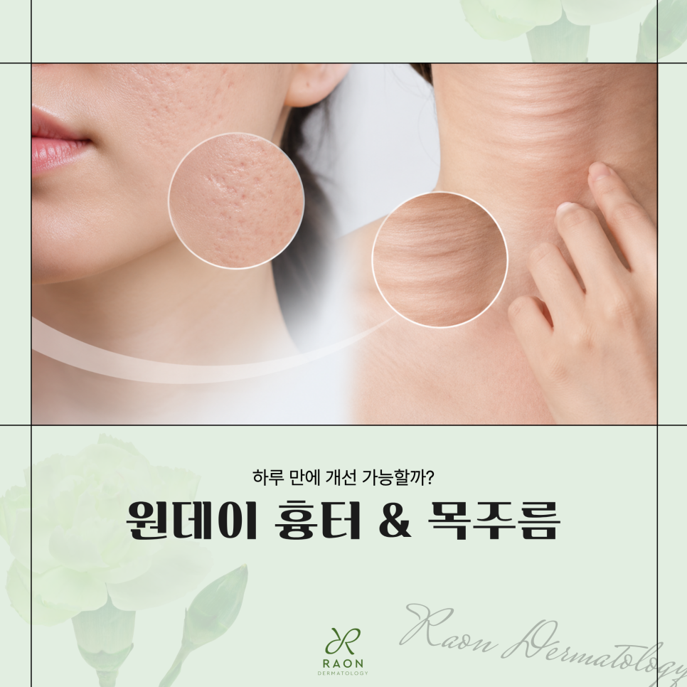 Haengdang Station Dermatology: One-Day Treatment for Raised Scars & Neck Wrinkles—Can They Improve in Just One Day? image 1