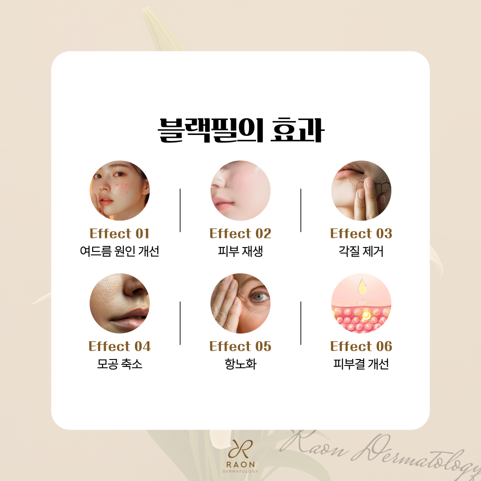 From Exfoliation to Acne Treatment, Black Peel and Aqua Peel at Geumho-dong Dermatology Clinic image 4