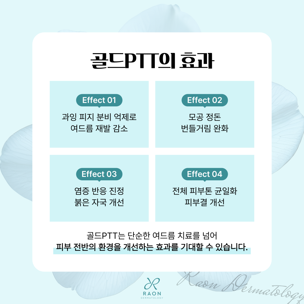 답십리 피부과 염증성 여드름 자꾸만 재발한다면? 피지선 파괴술 & 골드PTT 치료 관련 이미지 4