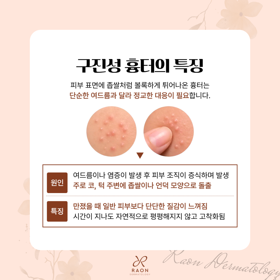 Seongdong-gu Dermatology: Is Shaving-Off Treatment the Only Answer for Papular Scars and Hypertrophic Scars? [Chief Director Skin Column] image 2