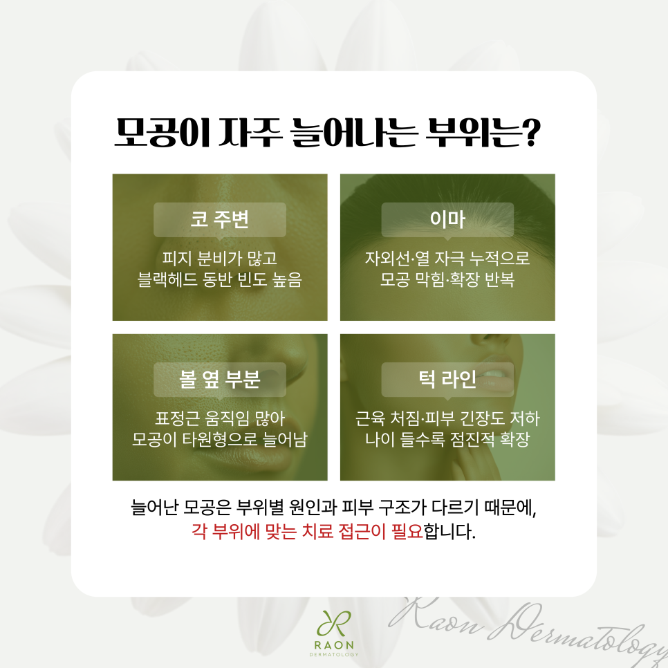 뚝섬 피부과 늘어난 모공 리써FX부터 미라젯, 쥬베룩까지, 나에게 맞는 방법은? 관련 이미지 2