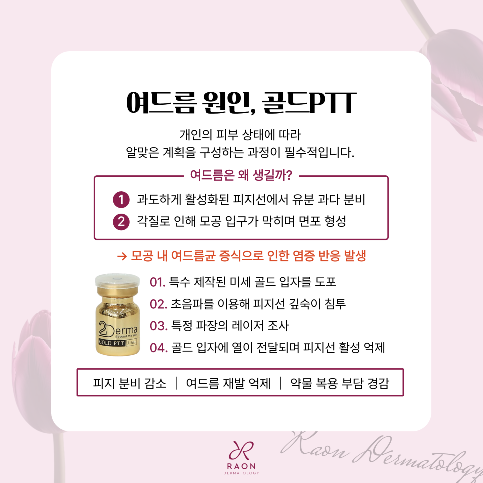 Seongdong-gu Dermatology Clinic: Step-by-Step Acne Care, from Sebum Production to Enlarged Pores image 2