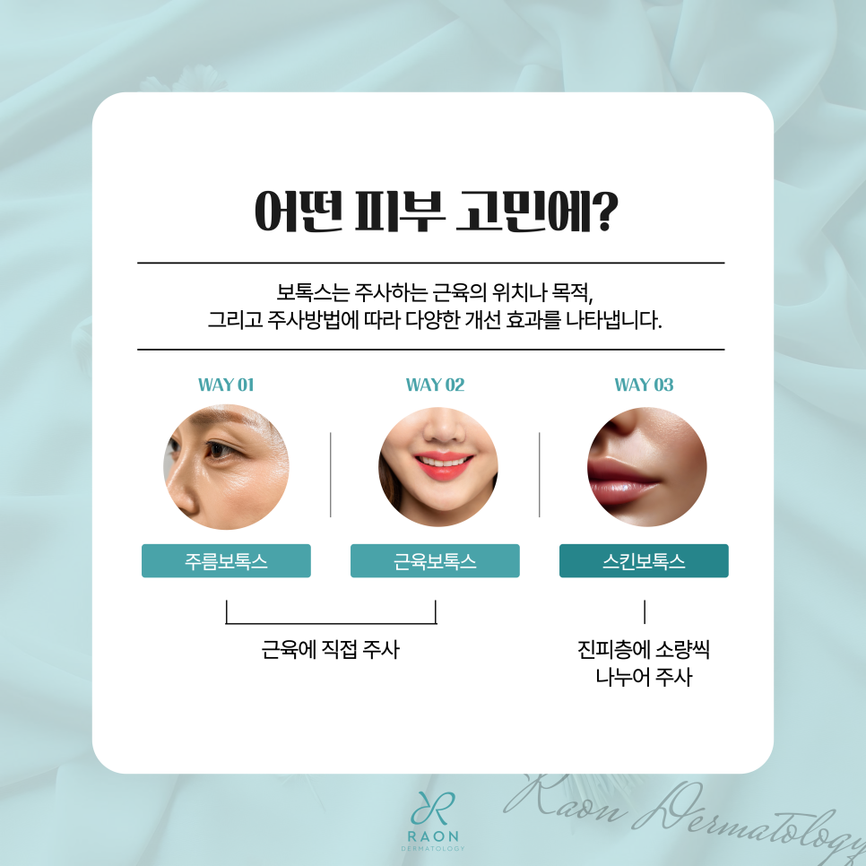 왕십리역 피부과 보톡스 활용법 주름, 근육, 피부 환경까지? 관련 이미지 2