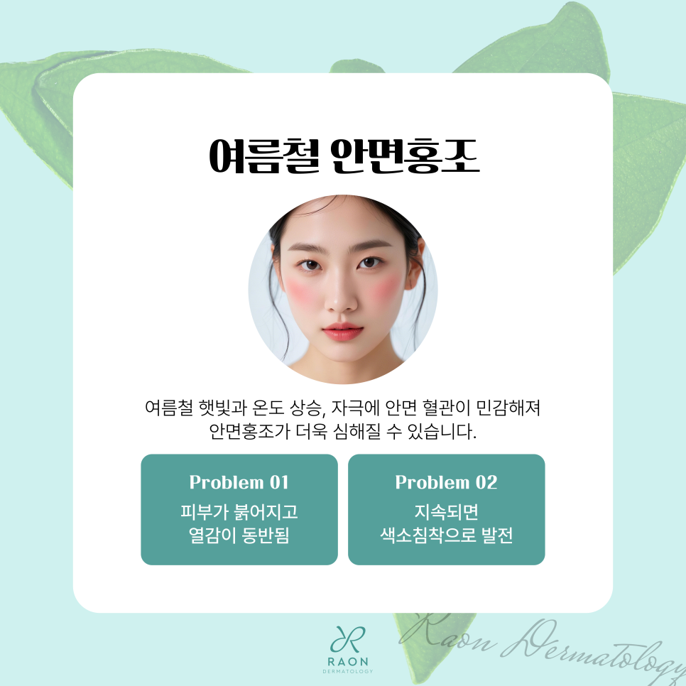 성동구 피부과 여름철 안면홍조 & 색소침착 치료 레이저, 여드름 붉은기까지 관련 이미지 4