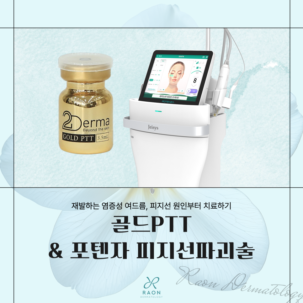 답십리 피부과 염증성 여드름 자꾸만 재발한다면? 피지선 파괴술 & 골드PTT 치료 관련 이미지 1