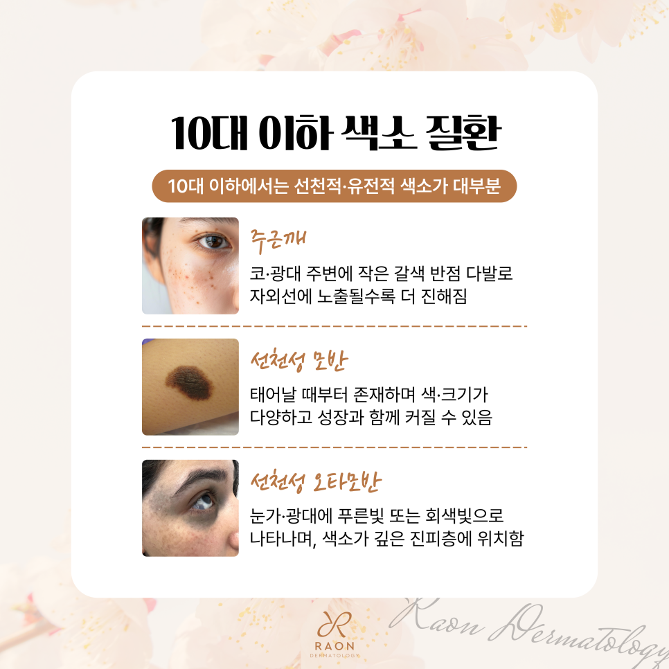 Sangwangsimni Dermatology: Common Pigment Disorders by Age Group—How Should They Be Treated? image 3