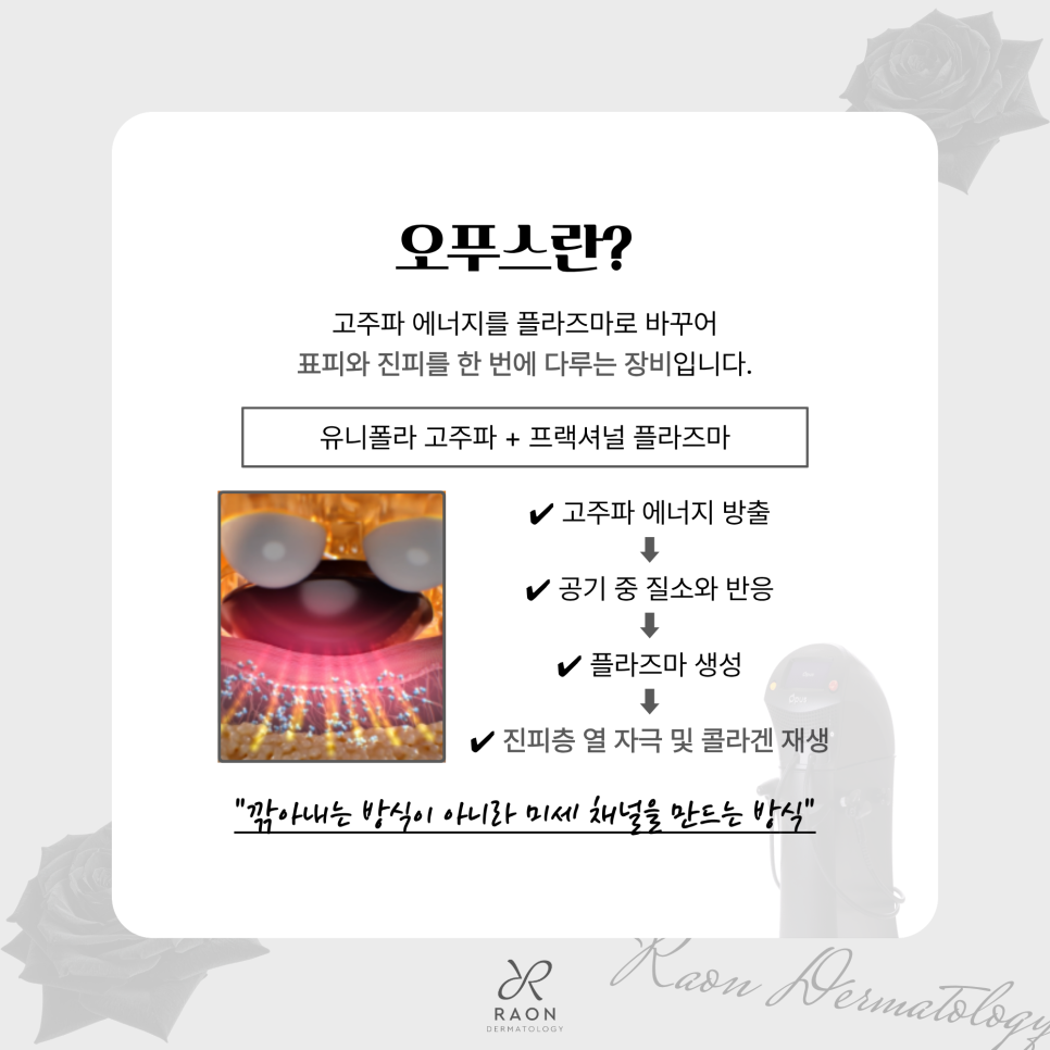왕십리역 피부과 오푸스 레이저 신규 도입 색소부터 여드름 및 흉터까지 관련 이미지 2