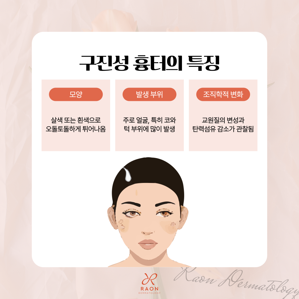 How Does a Dermatology Specialist in Wangsimni Treat Papular Scars and Hypertrophic Scars? image 4