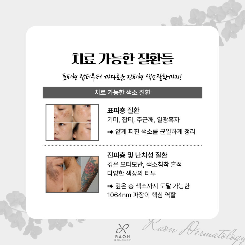 성동구 피부과 전문의 헐리우드 스펙트라 포함 듀얼 레이저 토닝 치료 가능한 색소는? 관련 이미지 4