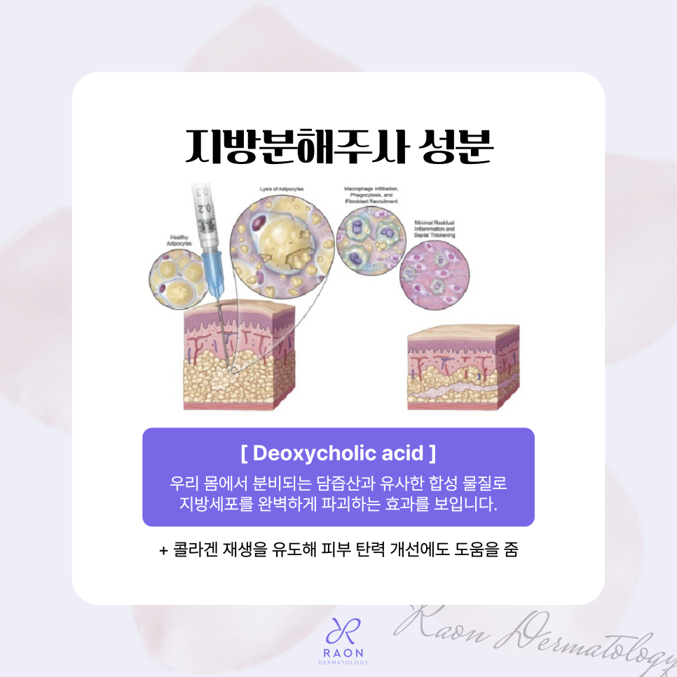 Chief Director’s Skin Column｜Seongdong-gu Dermatology: What Are the Real Uses of Fat-Dissolving Injections Such as V-OLET? image 3