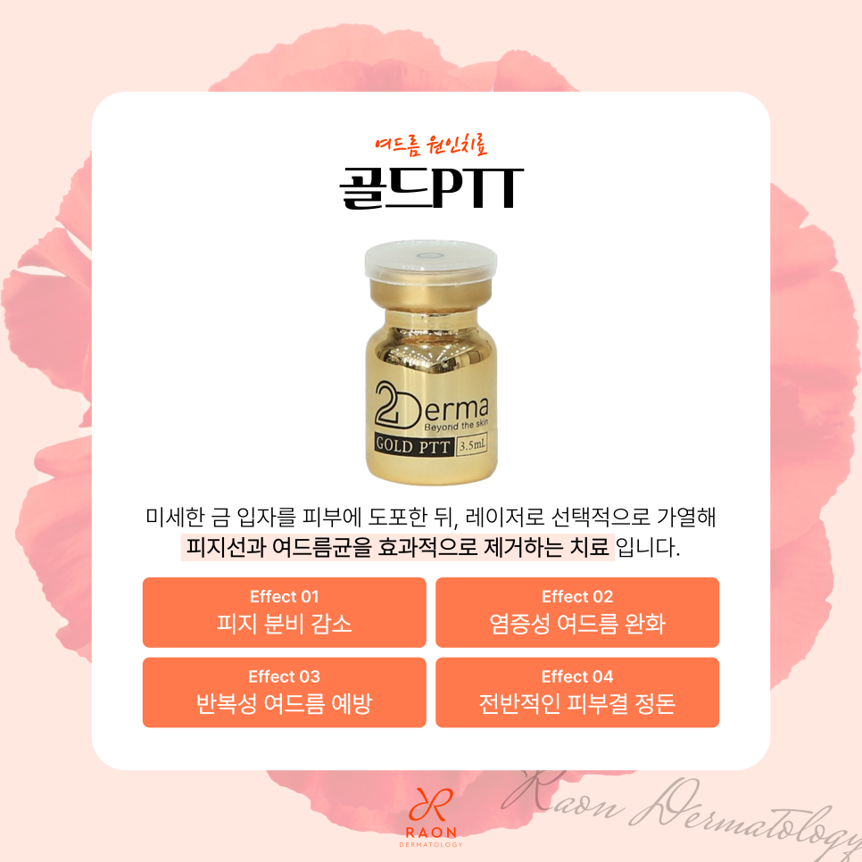 잊을만하면 올라오는 여드름? 재발까지 고려한 성동구 피부과 여드름 치료 프로세스 관련 이미지 3