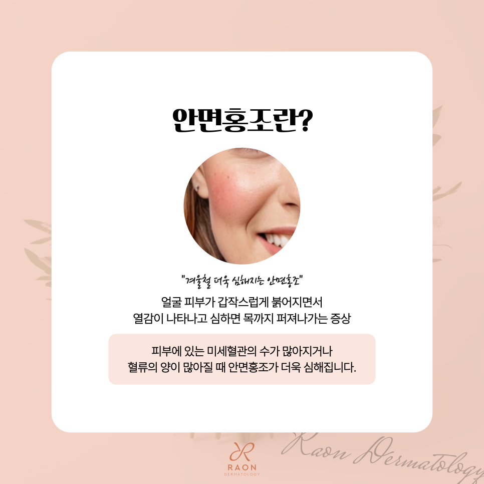 왕십리역 피부과 안면홍조 레이저 치료, 피부과 전문의에게 받아야 하는 이유? 관련 이미지 2