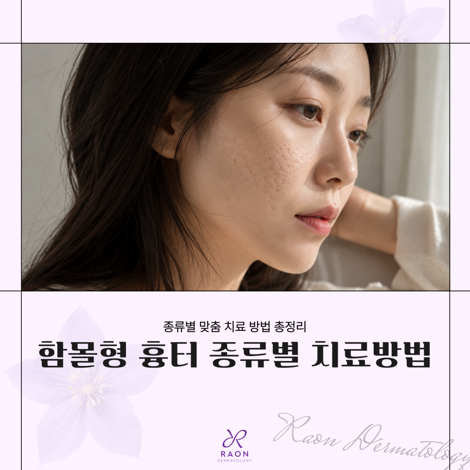 How deeply indented atrophic scars are treated at Wangsimni Dermatology [Laser, Subcision, Regenerative Injection] image 1