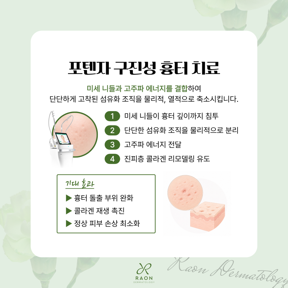 Haengdang Station Dermatology: One-Day Treatment for Raised Scars & Neck Wrinkles—Can They Improve in Just One Day? image 3