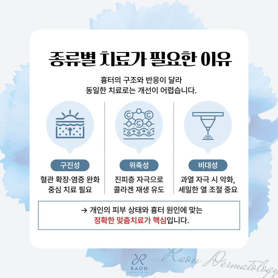 Hoehyeon Station Dermatology: Characteristics and Treatment Methods by Scar Type, and What Are the Benefits of Combining Mirajet and Juvelook? image 3