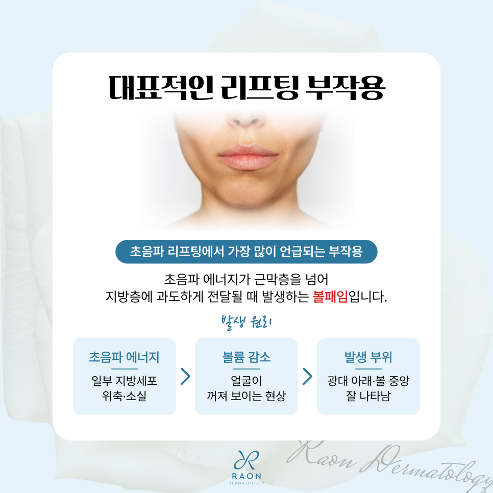 Precautions for Ultrasound and Radiofrequency Lifting at Haengdang-dong Dermatology: Safe Without Side Effects image 3