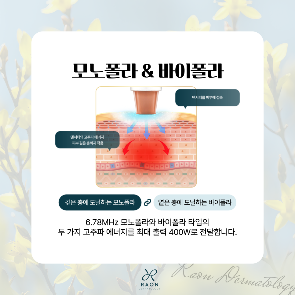 새로운 고주파 리프팅, 왕십리 피부과 덴서티 하이 리프팅 효과는? 관련 이미지 3