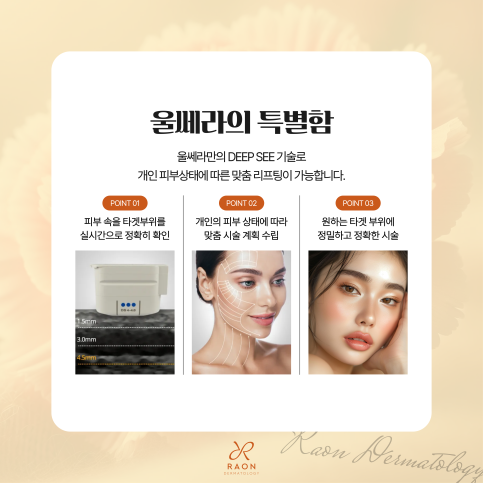 왕십리 피부과 전문의 울쎄라 리프팅, 심부볼과 이중턱에 좋은 이유? 관련 이미지 4