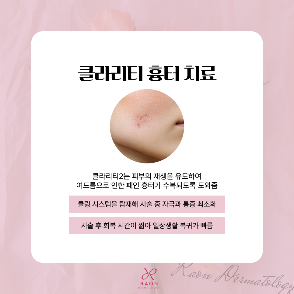 신금호역 피부과 붉은 여드름 흉터 치료 클라리티2 & DDR 레이저 관련 이미지 3