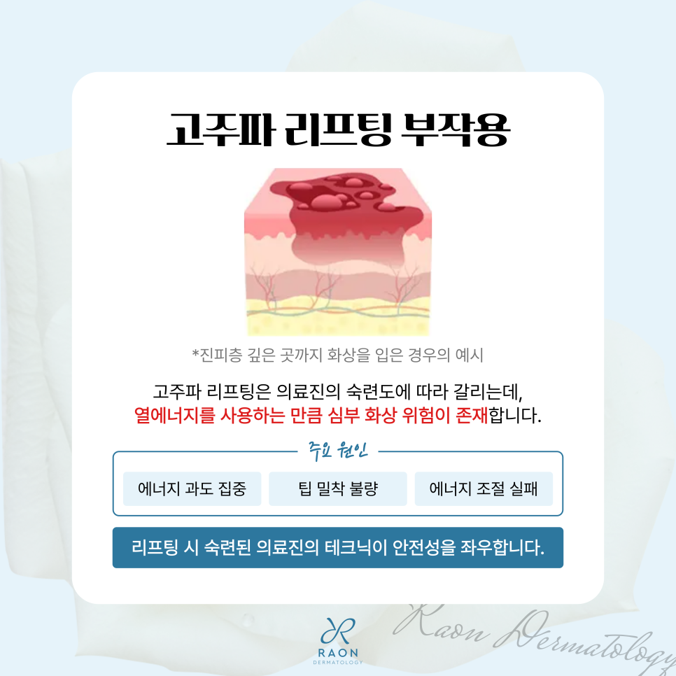 Precautions for Ultrasound and Radiofrequency Lifting at Haengdang-dong Dermatology: Safe Without Side Effects image 5