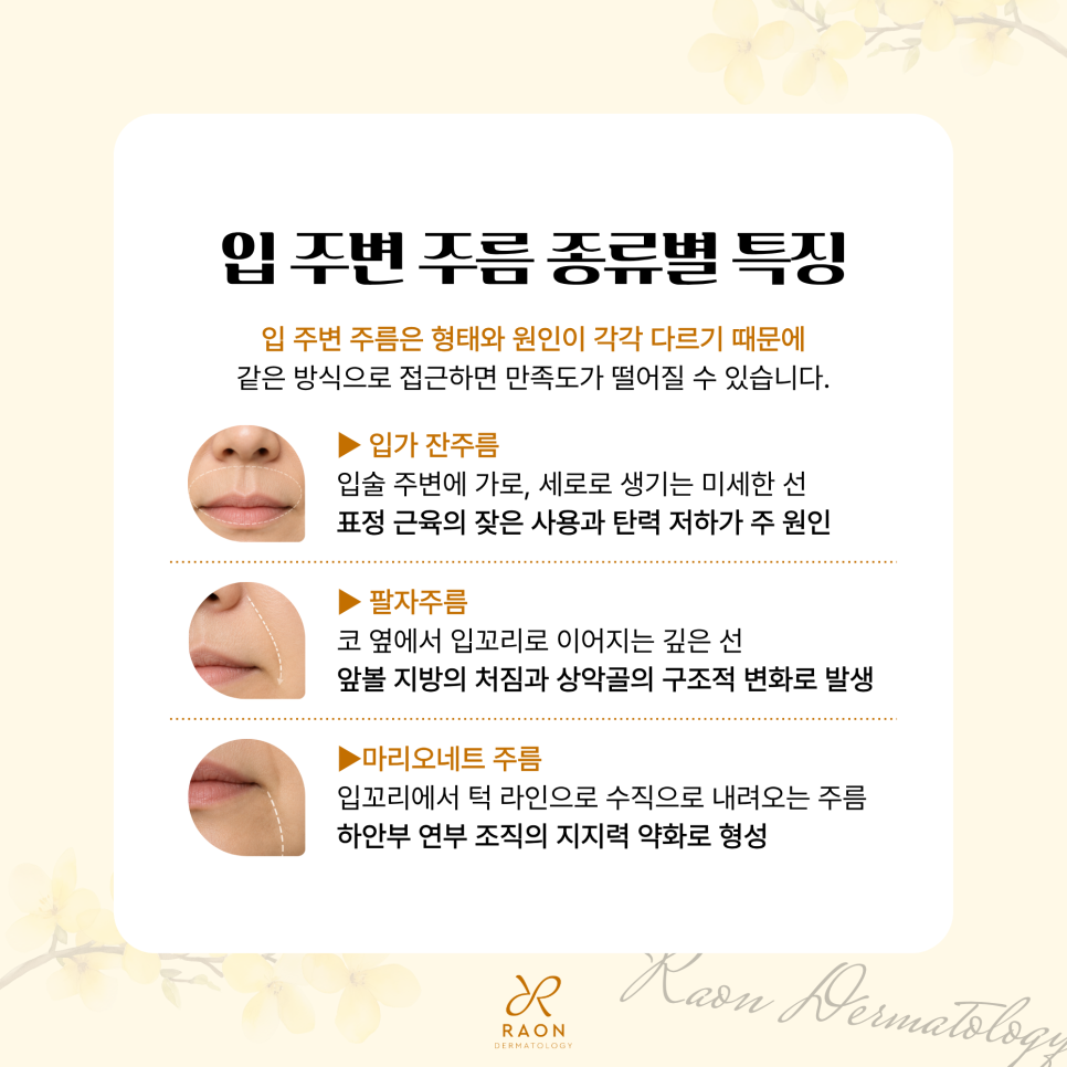 행당동 피부과 입 주변 잔주름부터 마리오네트주름까지 주사와 리프팅을 활용한 개선법 관련 이미지 2