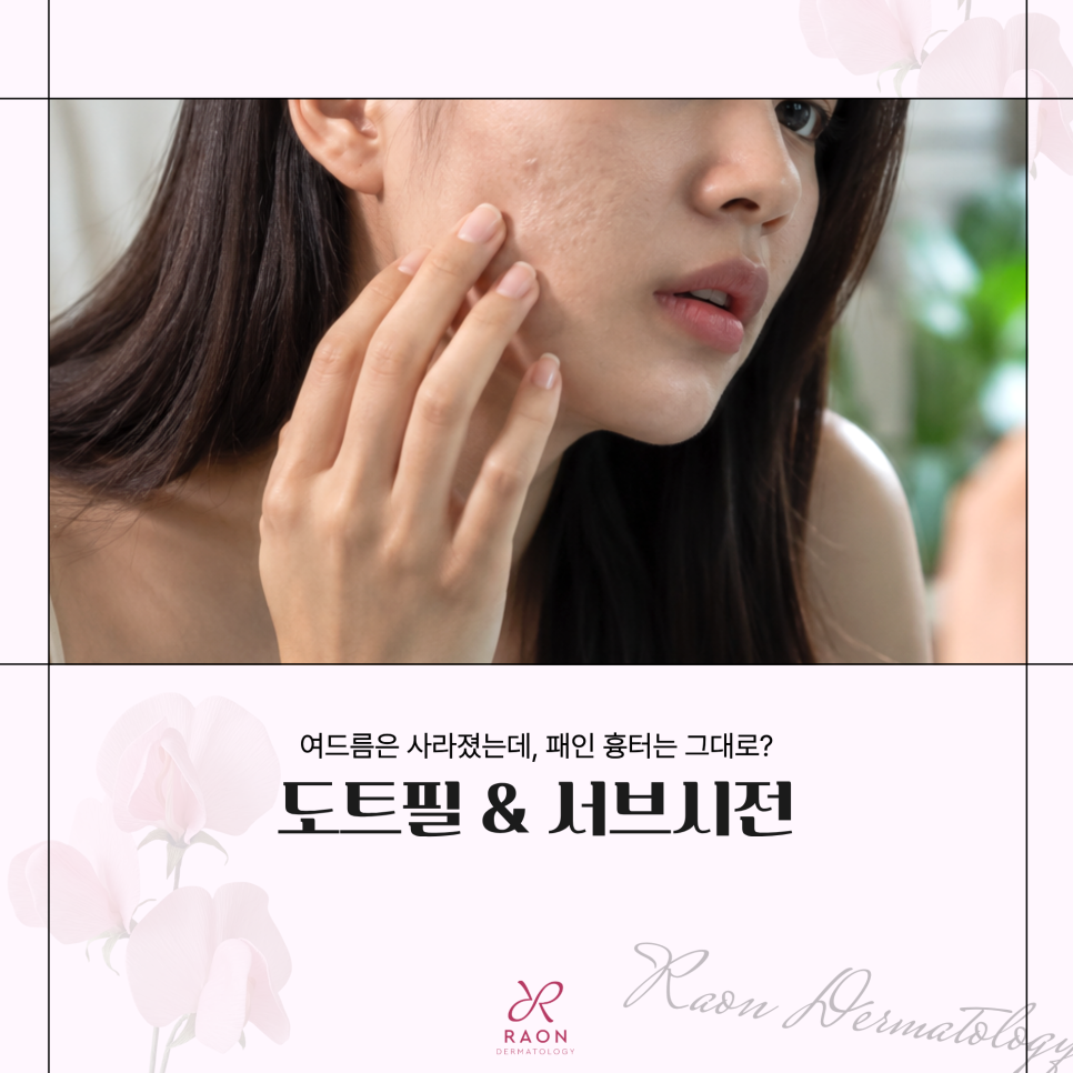 왕십리 피부과 여드름 흉터 도트필과 서브시전 피부과 전문의 치료가 필요한 이유? 관련 이미지 1