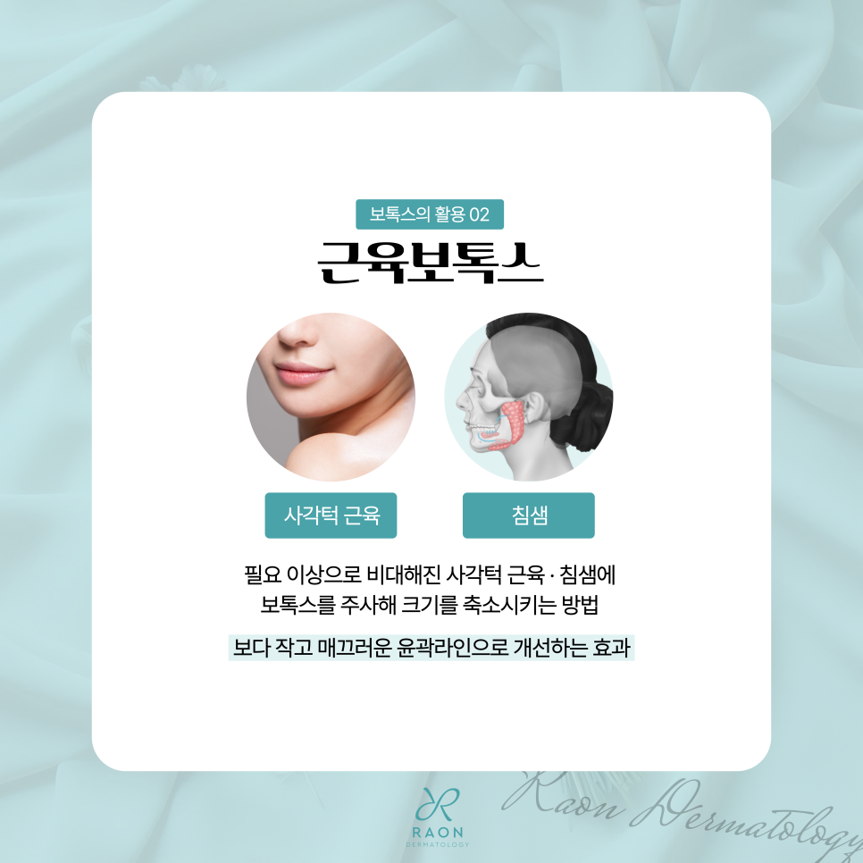왕십리역 피부과 보톡스 활용법 주름, 근육, 피부 환경까지? 관련 이미지 4