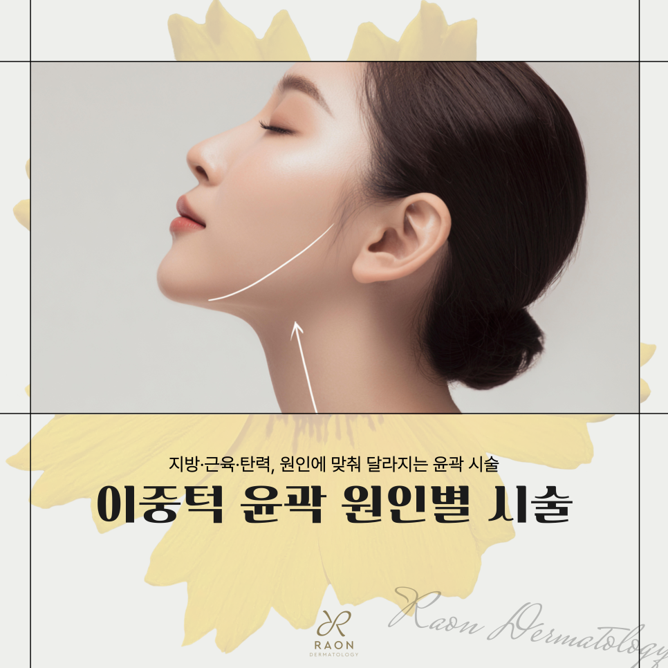 Double Chin and Facial Contour Concerns: Improving Them with Ulthera and Square Jaw Botox at Wangsimni Dermatology Clinic image 1