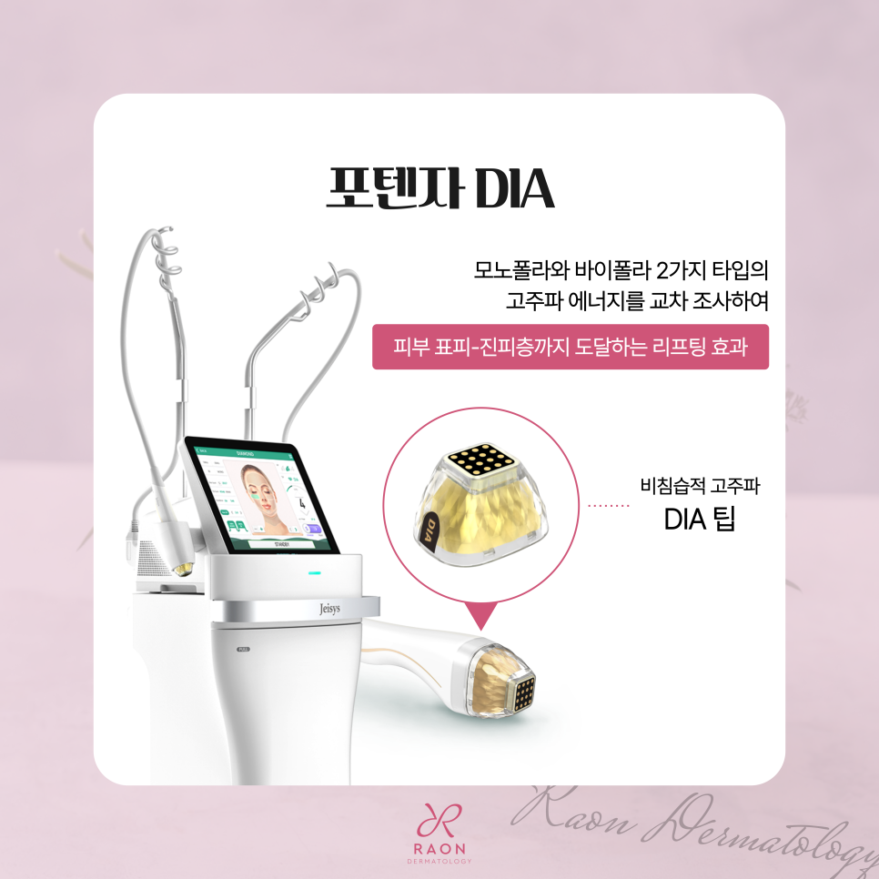 행당역 피부과 리프팅시술로 안면부 처짐 개선하기 (울쎄라 &middot; 포텐자 다이아) 관련 이미지 4