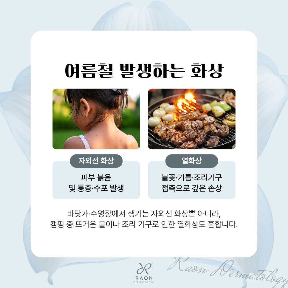 How Is Burn Treatment Handled During a Summer Vacation? From Initial Response to Treatment at a Wangsimni Dermatology Clinic image 2