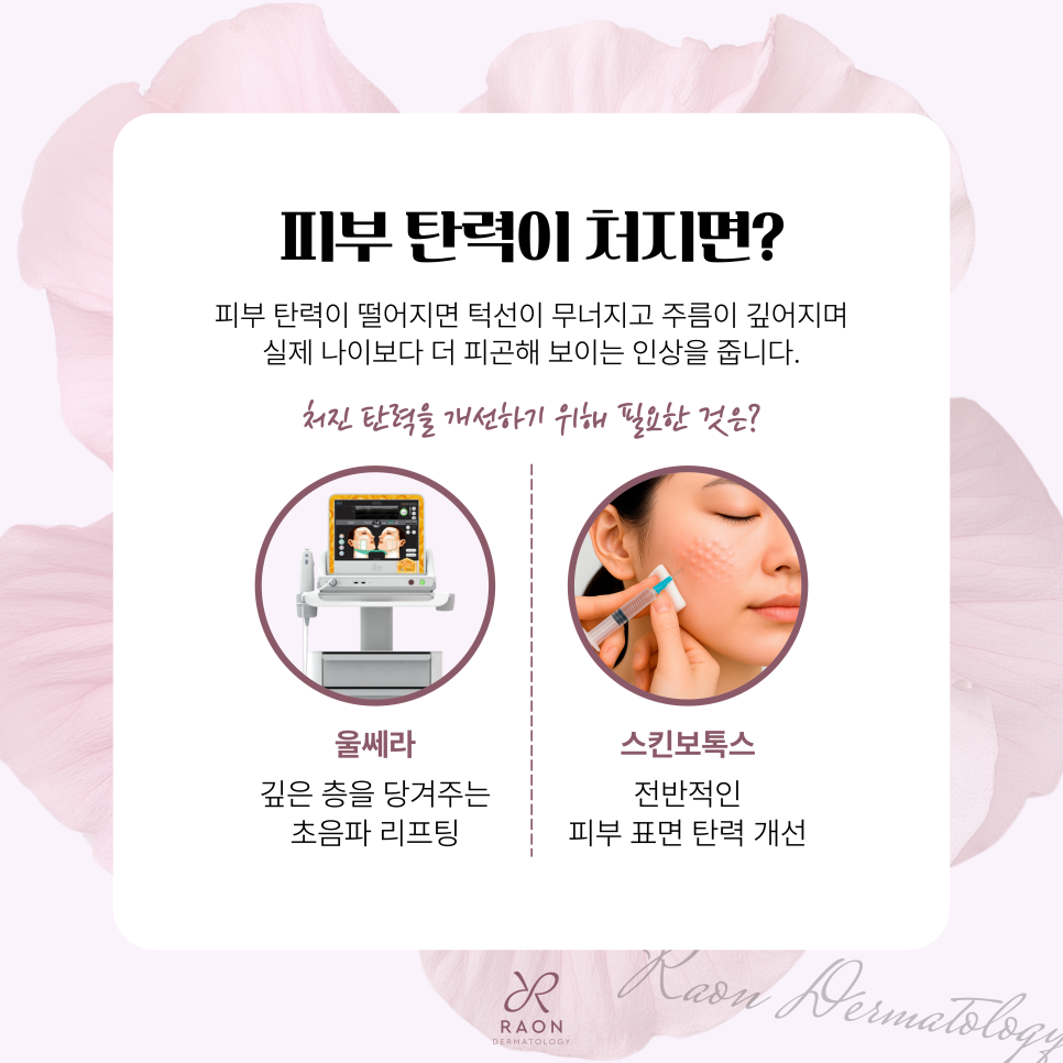 Gwangjin-gu Dermatology: Combining Ulthera and Skin Botox to Improve Sagging and Elasticity at the Same Time image 2