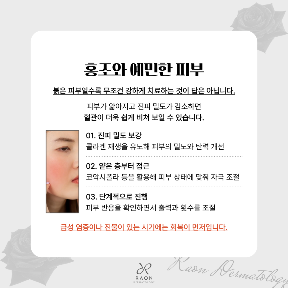 왕십리역 피부과 오푸스 레이저 신규 도입 색소부터 여드름 및 흉터까지 관련 이미지 5