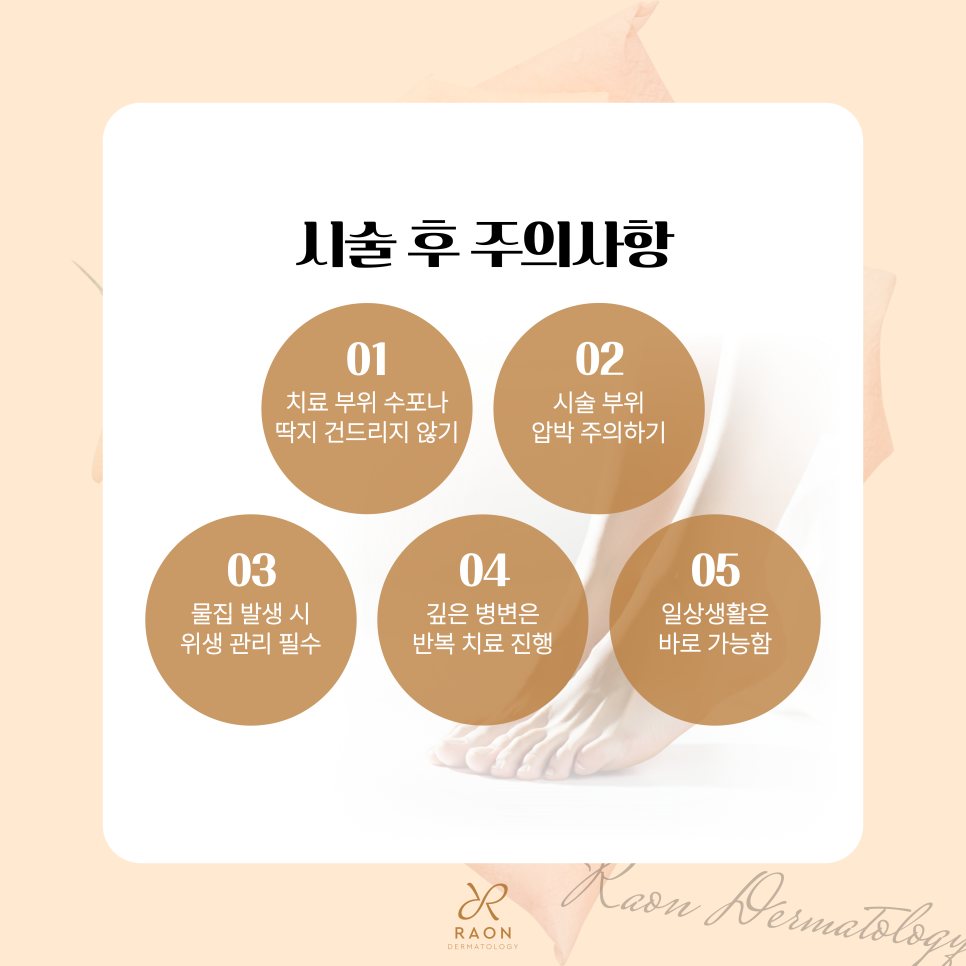 성동구 피부과 전문의의 티눈 냉동치료, 제거 후 관리방법은? 관련 이미지 6
