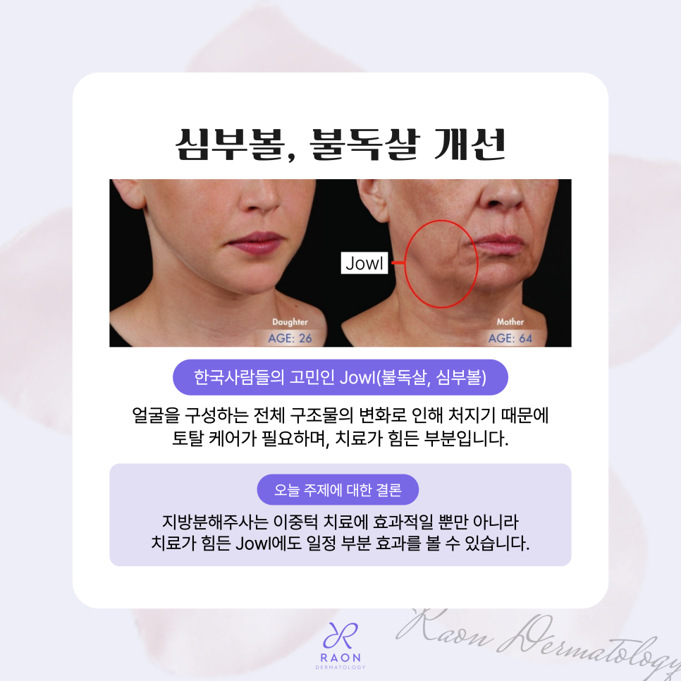 Chief Director’s Skin Column｜Seongdong-gu Dermatology: What Are the Real Uses of Fat-Dissolving Injections Such as V-OLET? image 6