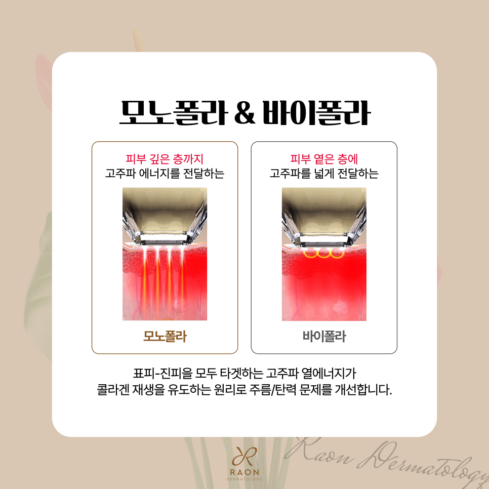 신금호역 피부과 얼굴 주름과 탄력을 잡다, 포텐자 다이아 & 쥬베룩 관련 이미지 4
