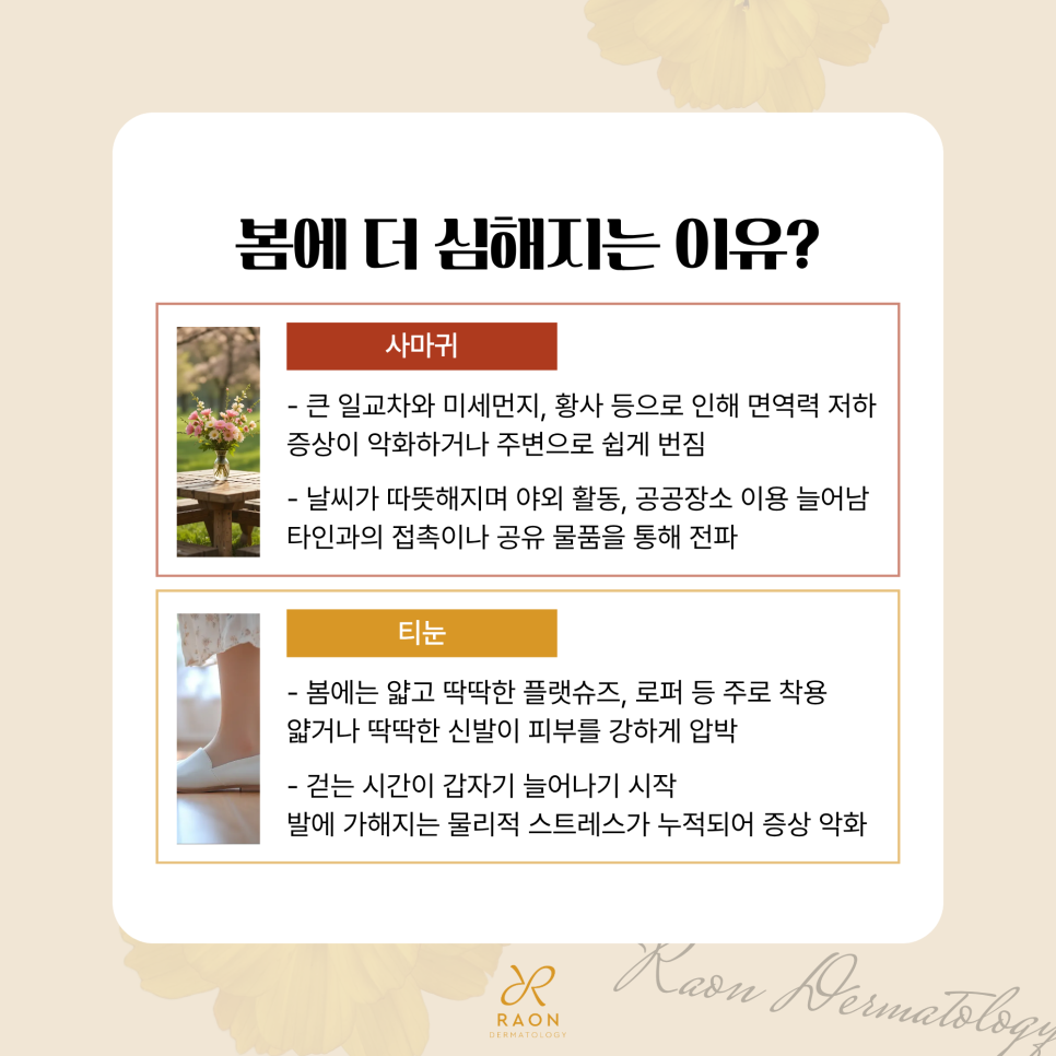 왕십리 피부과 사마귀와 티눈 등 CO2 레이저 제거, 냉동치료와의 비교 관련 이미지 3